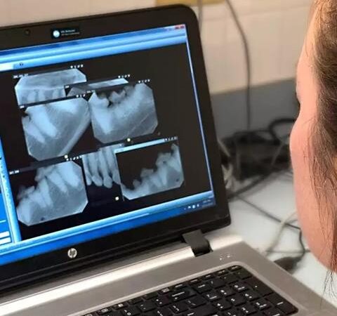 dental x-rays